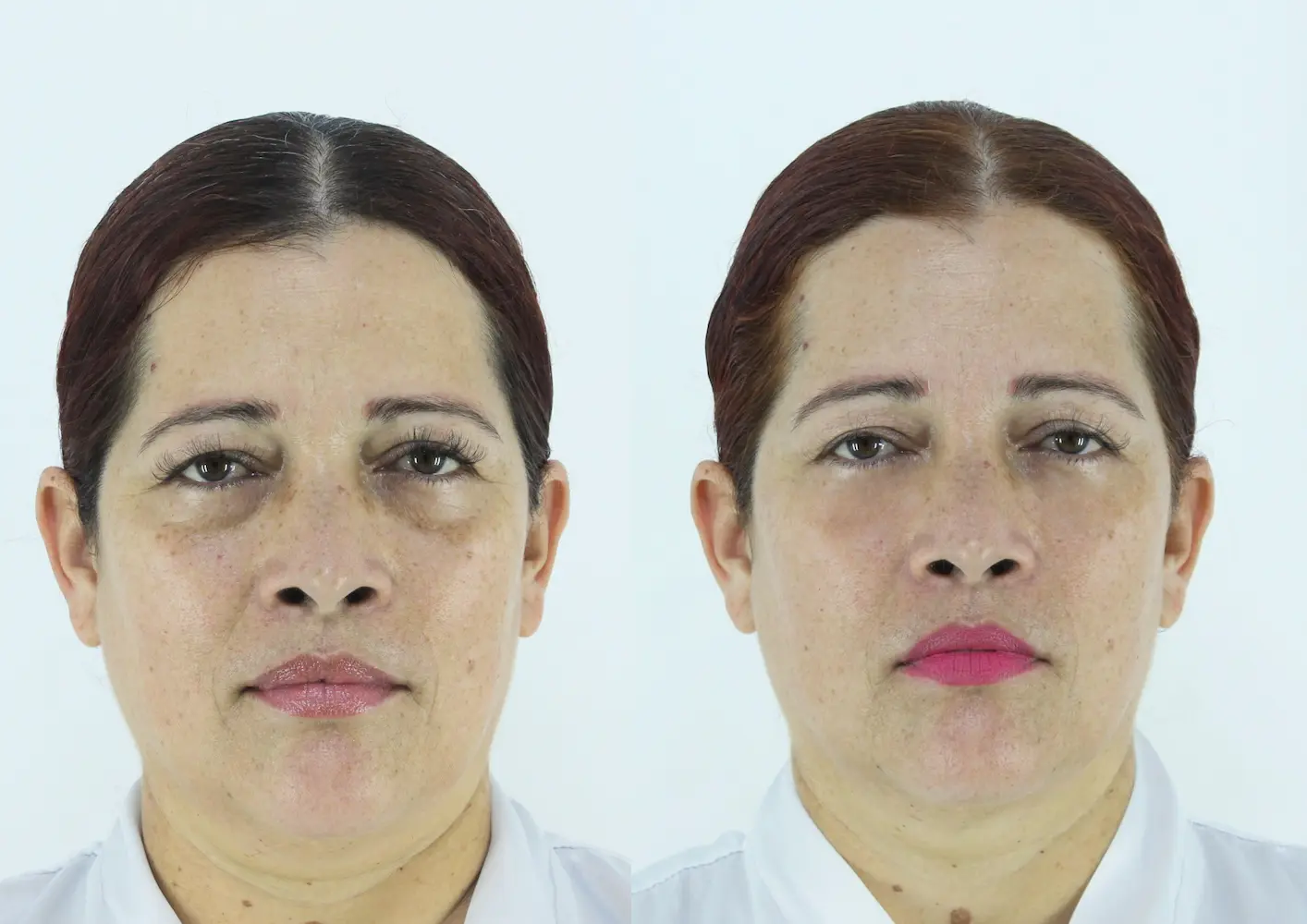 Antes y después de Francis - imagen 1