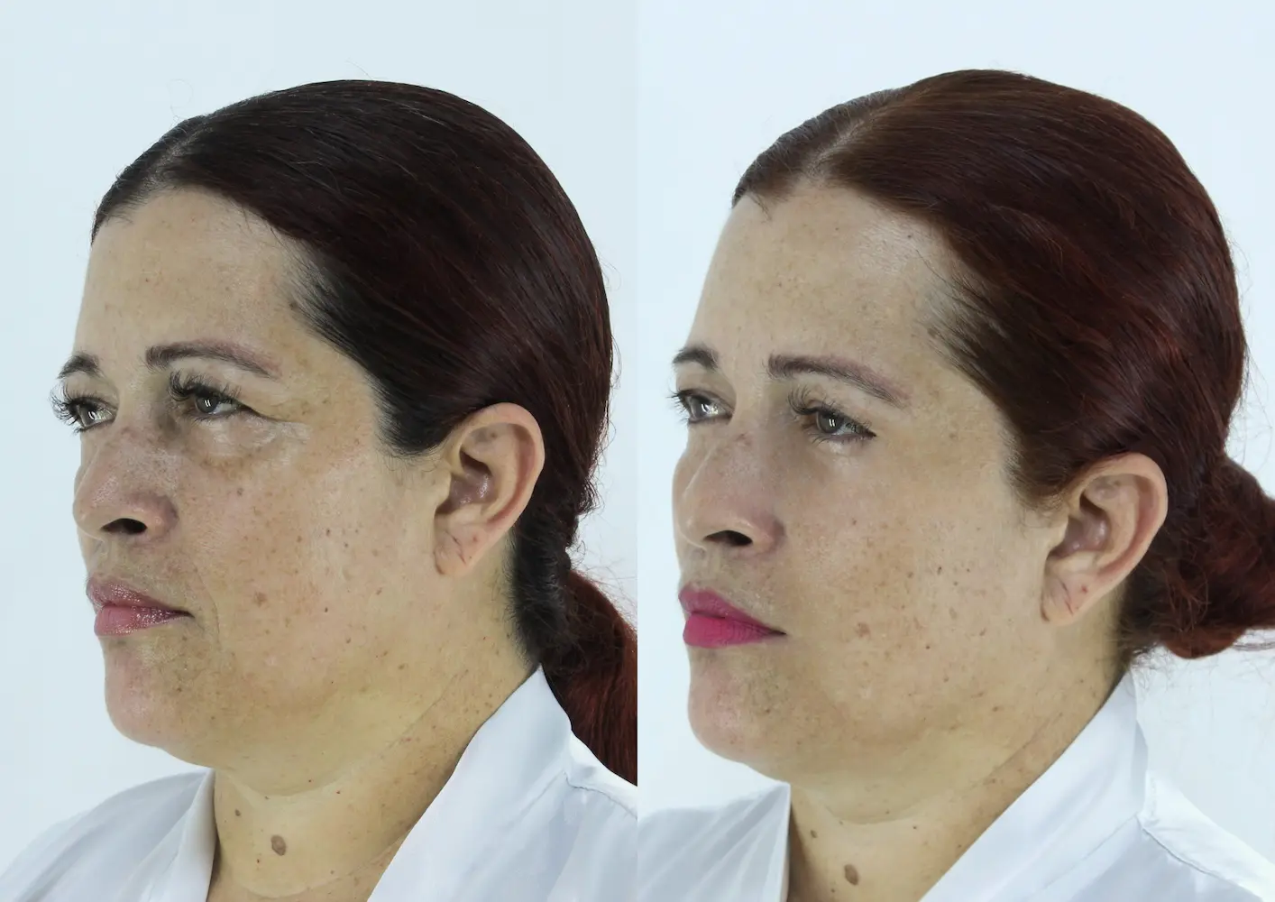 Antes y después de Francis - imagen 2