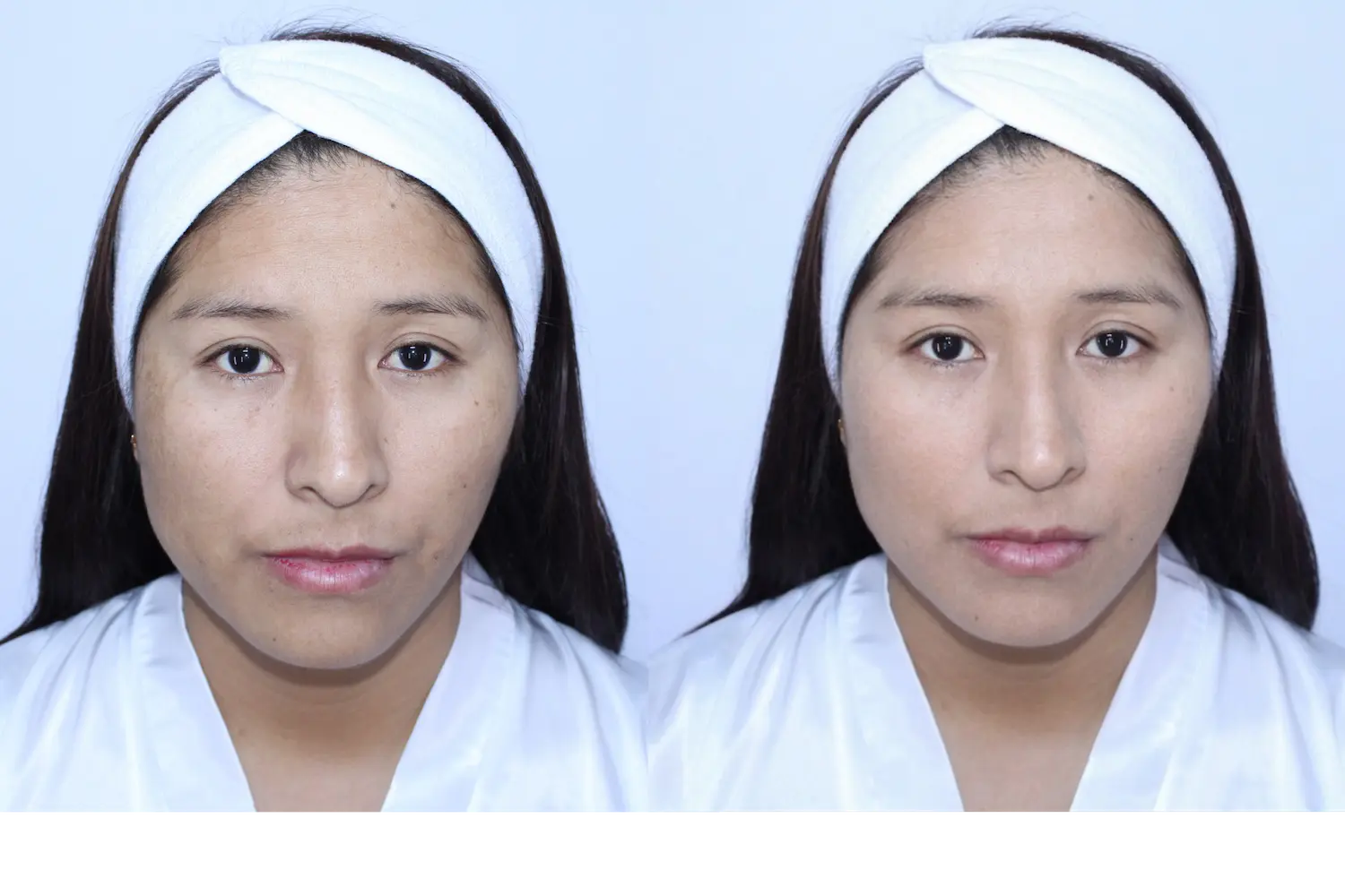 Antes y después de Teresa - imagen 1