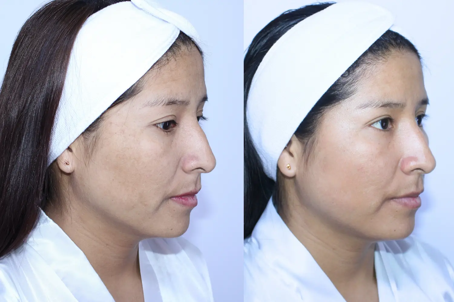 Antes y después de Teresa - imagen 2