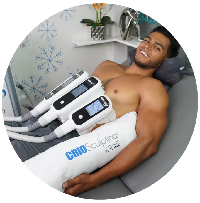 Criosculpting