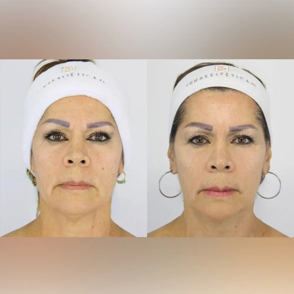 Resultado PicoGlow 2