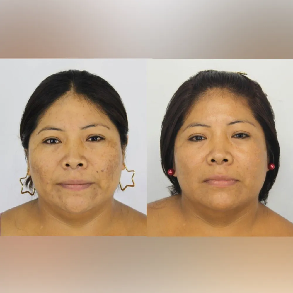 Resultado PicoGlow 4