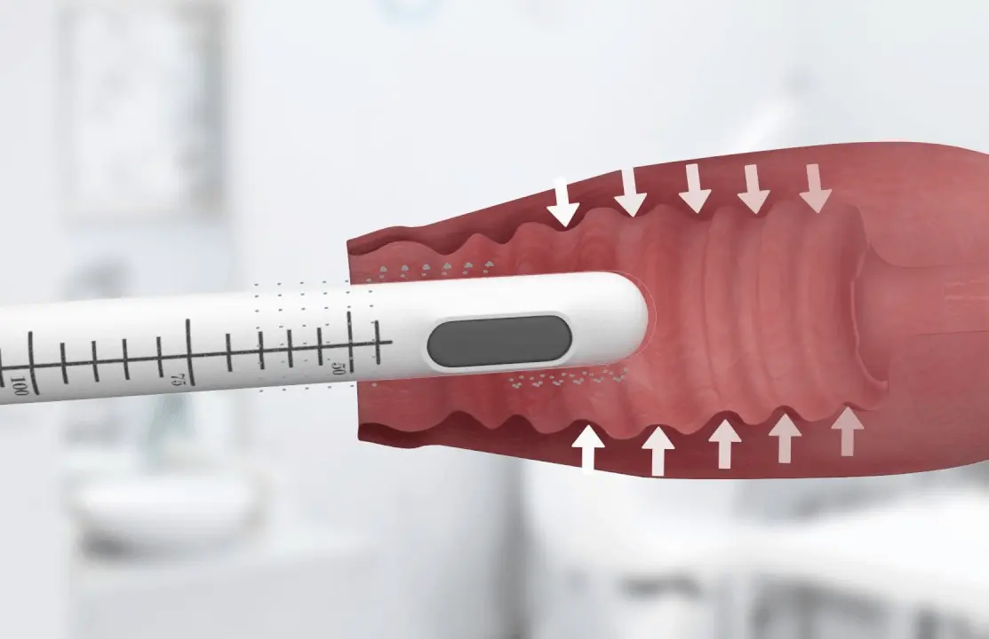 SmartLift® PRO Vaginal Tightening