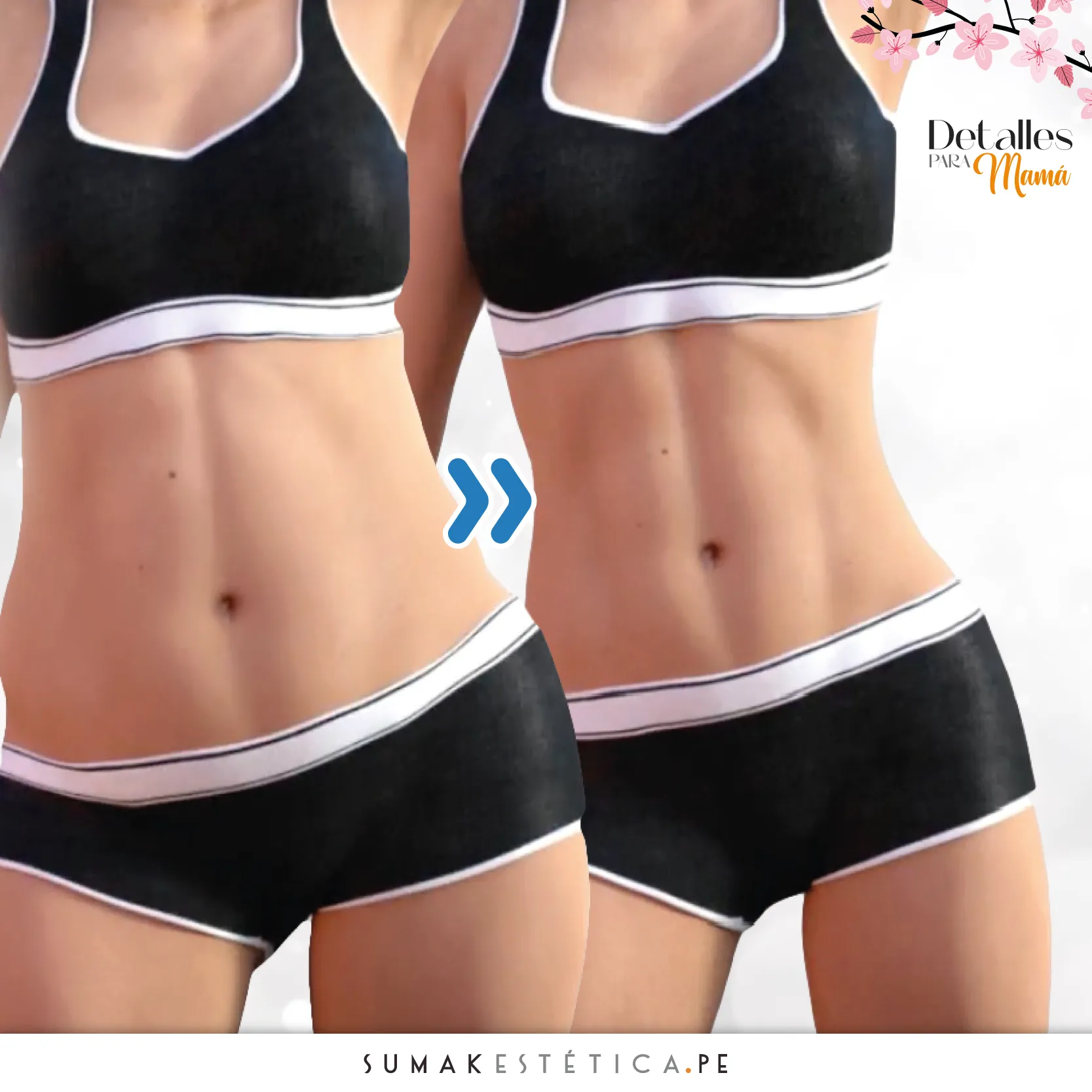 Criosculpting® Elite